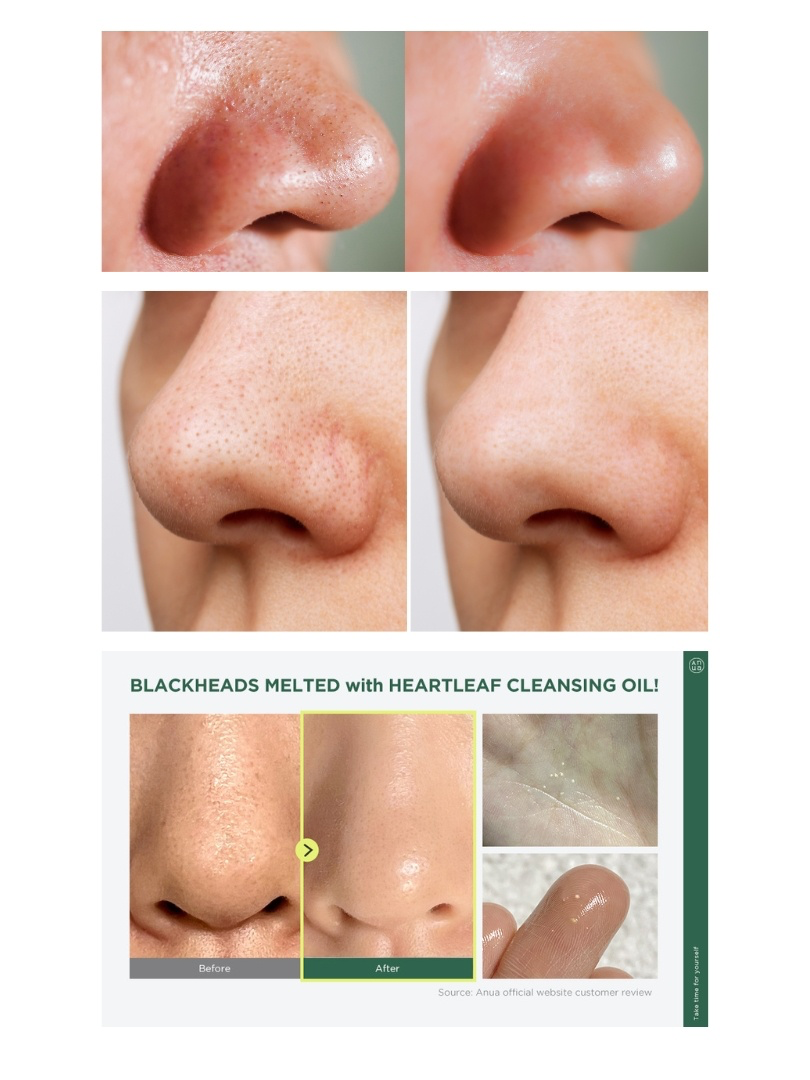 Anua Heartleaf Pore Control Cleansing 200ml – Έλαιο για βαθύ καθαρισμό των πόρων
