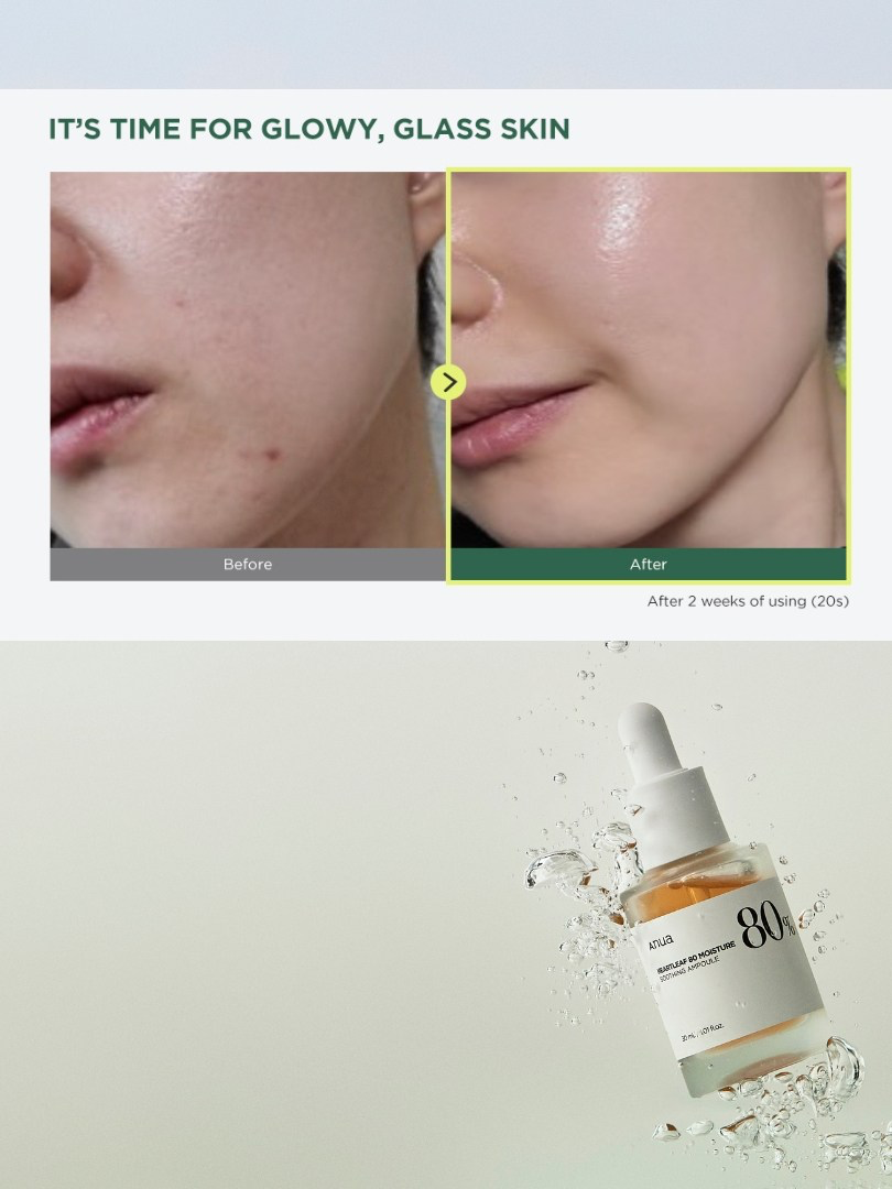 Anua Heartleaf 80% Soothing Ampoule 30ml – Ενυδατική καταπραϋντική αμπούλα για glass skin
