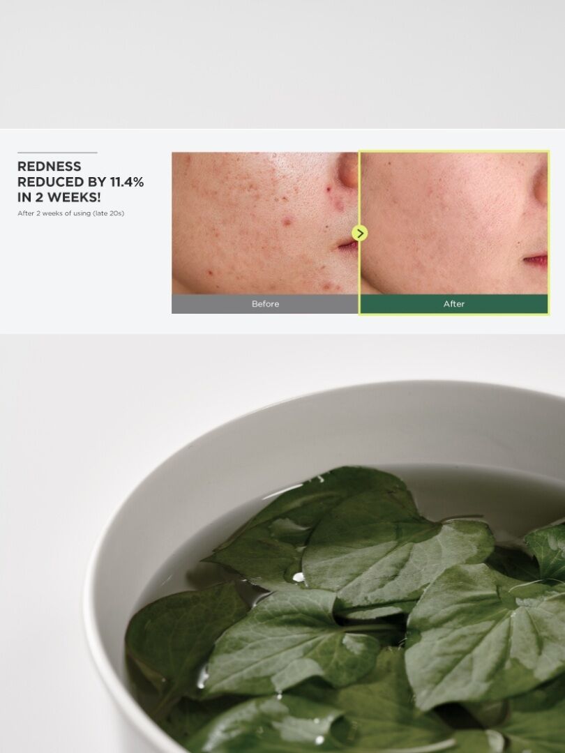 Anua Heartleaf 77% soothing toner – Ενυδατικό, καταπραϋντικό τόνερ